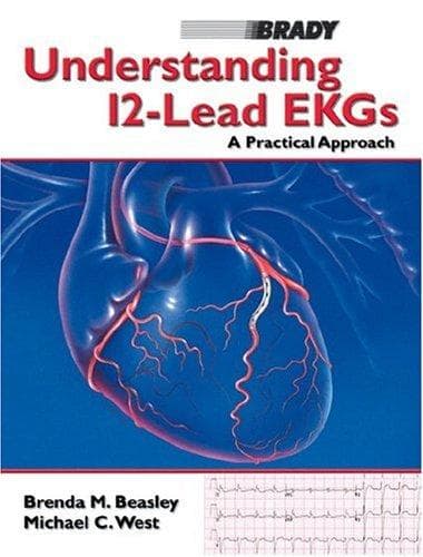 Understanding 12-lead EKGs