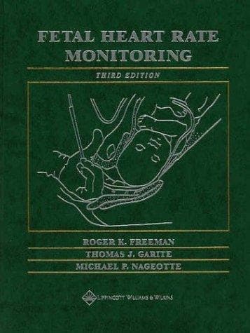 Fetal heart rate monitoring